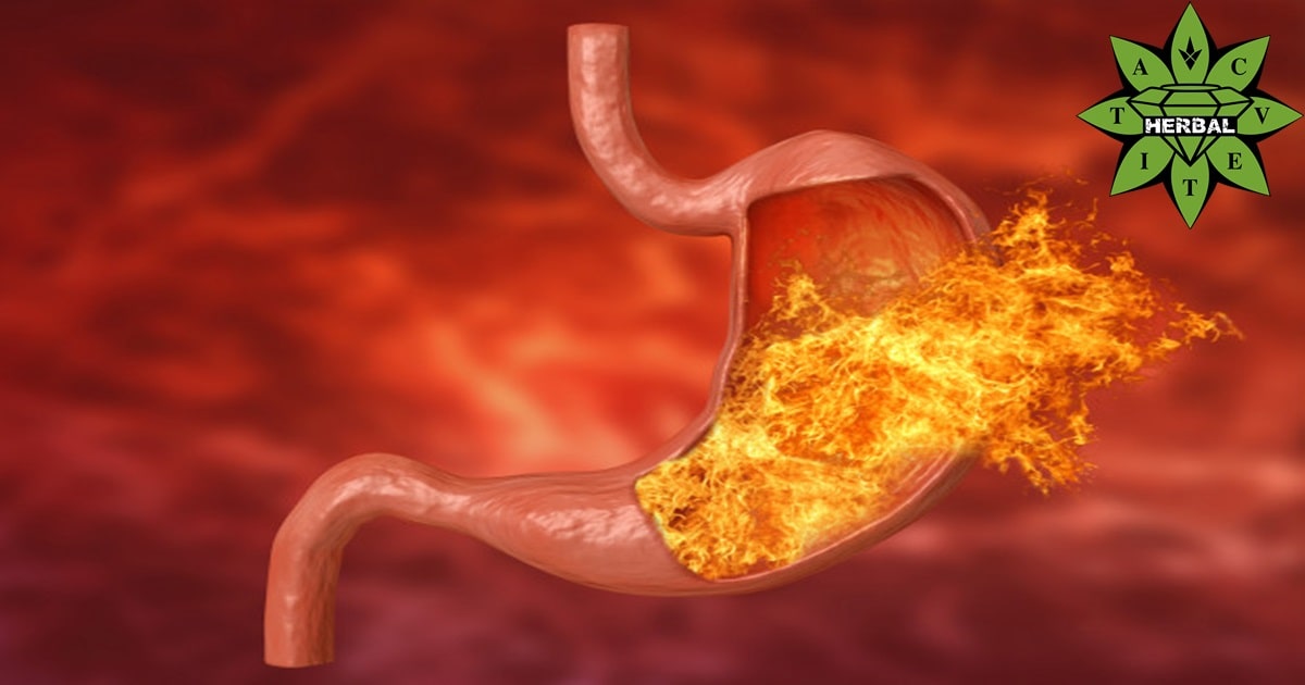 Киселини в Стомаха - Симптоми и Причини - Cvetita Herbal