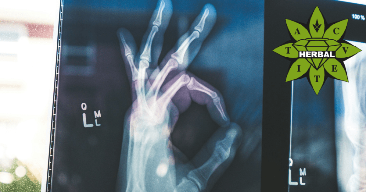 Колаген Ползи - За Какво Помага? - Cvetita Herbal